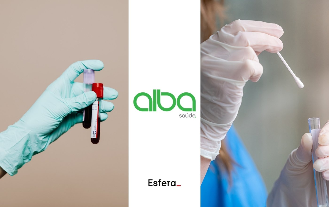 Como resgatar vale-compra Alba Saúde na Esfera e fazer teste de covid